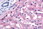 SLC5A4 Antibody in Immunohistochemistry (Paraffin) (IHC (P))