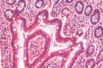 SLC5A4 Antibody in Immunohistochemistry (Paraffin) (IHC (P))