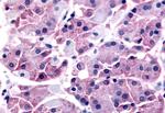 SLC7A11 Antibody in Immunohistochemistry (Paraffin) (IHC (P))