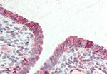 STEAP2 Antibody in Immunohistochemistry (Paraffin) (IHC (P))