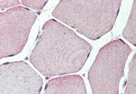 TXLNB Antibody in Immunohistochemistry (Paraffin) (IHC (P))