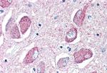 WNT8B Antibody in Immunohistochemistry (Paraffin) (IHC (P))