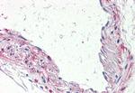 HTR1B Antibody in Immunohistochemistry (Paraffin) (IHC (P))