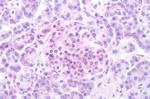 HTR1D Antibody in Immunohistochemistry (Paraffin) (IHC (P))