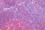 HTR2C Antibody in Immunohistochemistry (Paraffin) (IHC (P))