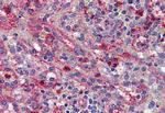 ACVR1C Antibody in Immunohistochemistry (Paraffin) (IHC (P))