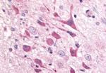 ADORA1 Antibody in Immunohistochemistry (Paraffin) (IHC (P))