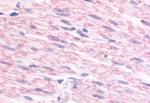 alpha-2c Adrenergic Receptor Antibody in Immunohistochemistry (Paraffin) (IHC (P))