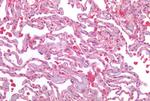 AGTR2 Antibody in Immunohistochemistry (Paraffin) (IHC (P))