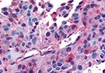 AVPR1B Antibody in Immunohistochemistry (Paraffin) (IHC (P))