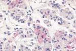 AVPR1B Antibody in Immunohistochemistry (Paraffin) (IHC (P))