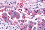 AVPR2 Antibody in Immunohistochemistry (Paraffin) (IHC (P))