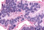 AVPR2 Antibody in Immunohistochemistry (Paraffin) (IHC (P))