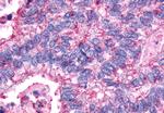 AVPR2 Antibody in Immunohistochemistry (Paraffin) (IHC (P))