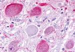 BAI3 Antibody in Immunohistochemistry (Paraffin) (IHC (P))