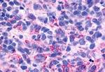 BAI3 Antibody in Immunohistochemistry (Paraffin) (IHC (P))