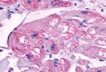 B1 Bradykinin Receptor Antibody in Immunohistochemistry (Paraffin) (IHC (P))