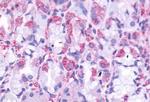 CCKBR Antibody in Immunohistochemistry (Paraffin) (IHC (P))