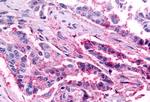 CCR1 Antibody in Immunohistochemistry (Paraffin) (IHC (P))