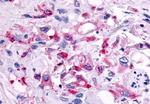 CCR1 Antibody in Immunohistochemistry (Paraffin) (IHC (P))