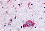 CCR1 Antibody in Immunohistochemistry (Paraffin) (IHC (P))