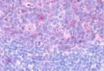 CCR3 Antibody in Immunohistochemistry (Paraffin) (IHC (P))