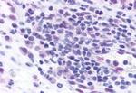 CCR3 Antibody in Immunohistochemistry (Paraffin) (IHC (P))