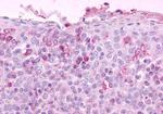 CCR3 Antibody in Immunohistochemistry (Paraffin) (IHC (P))