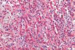 CCR6 Antibody in Immunohistochemistry (Paraffin) (IHC (P))