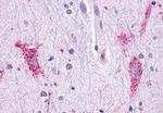 CCR9 Antibody in Immunohistochemistry (Paraffin) (IHC (P))