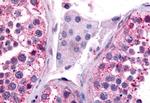 Cdc7 Antibody in Immunohistochemistry (Paraffin) (IHC (P))