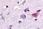 Cdc7 Antibody in Immunohistochemistry (Paraffin) (IHC (P))