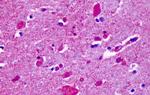 CELSR2 Antibody in Immunohistochemistry (Paraffin) (IHC (P))