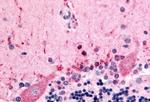 CELSR3 Antibody in Immunohistochemistry (Paraffin) (IHC (P))