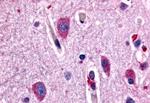 CHRM2 Antibody in Immunohistochemistry (Paraffin) (IHC (P))