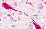 CMKLR1 Antibody in Immunohistochemistry (Paraffin) (IHC (P))