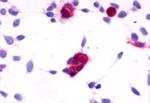 Cannabinoid Receptor 1 Antibody in Immunocytochemistry (ICC/IF)