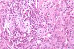 CXCR3 Antibody in Immunohistochemistry (Paraffin) (IHC (P))