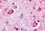 DPP6 Antibody in Immunohistochemistry (Paraffin) (IHC (P))