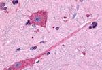 DRD2 Antibody in Immunohistochemistry (Paraffin) (IHC (P))