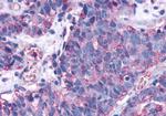 EDG3 Antibody in Immunohistochemistry (Paraffin) (IHC (P))