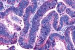 LPAR3 Antibody in Immunohistochemistry (Paraffin) (IHC (P))