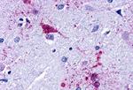 LPAR3 Antibody in Immunohistochemistry (Paraffin) (IHC (P))