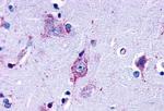 LPAR3 Antibody in Immunohistochemistry (Paraffin) (IHC (P))