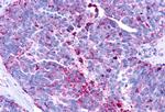 LPAR3 Antibody in Immunohistochemistry (Paraffin) (IHC (P))