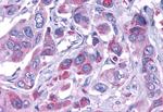 ELTD1 Antibody in Immunohistochemistry (Paraffin) (IHC (P))