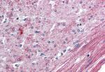 ELTD1 Antibody in Immunohistochemistry (Paraffin) (IHC (P))