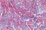 EphB2 Antibody in Immunohistochemistry (Paraffin) (IHC (P))