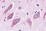 ESRRA Antibody in Immunohistochemistry (Paraffin) (IHC (P))