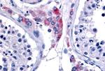 ESRRB Antibody in Immunohistochemistry (Paraffin) (IHC (P))